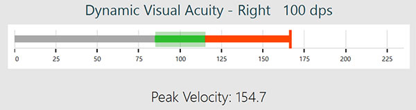 Velocity bar for DVA right, 100 dps. The velocity bar is a single-axis, horizontal graph, ranging from 0 to 225 degrees per second. The proper head speed range is marked with a green area and is approximately between 85 to 115 degrees per second. The head speed in this instance is 154.7, indicated by a red, solid line. The portion of the bar from 115 to 154.7 is also red.
