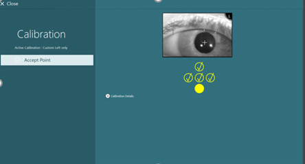 Five dots below eye imagery, four of which have a yellow checkmark. Shows test progress with checkmarks for correctly calibrated points.