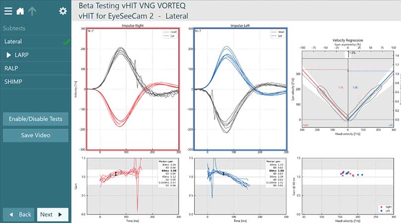 Normal values for velocity regression, head velocity and gain.