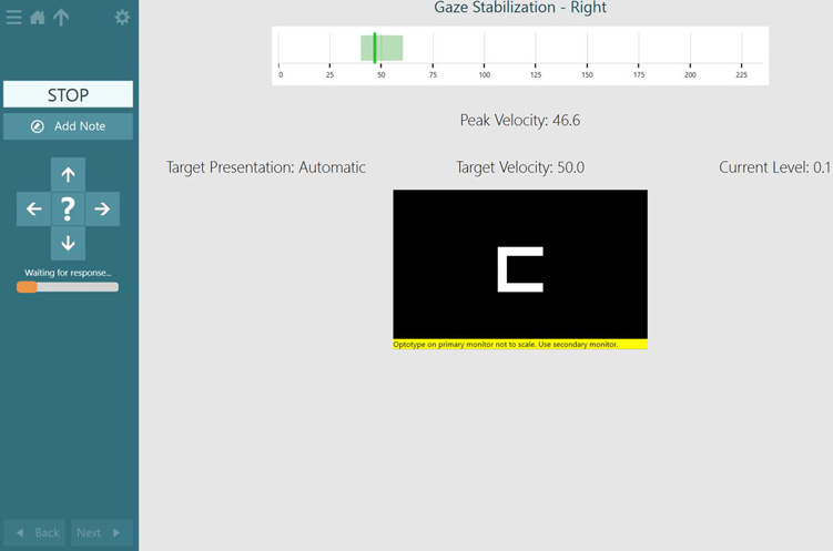 The target velocity is 50 degrees per second, with the acceptable green area lying between about 40 to 60. The patient has achieved a peak velocity of 46.6.