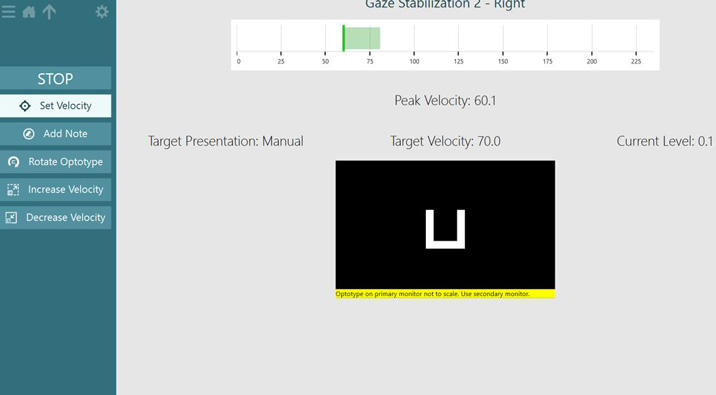 The user has the options to stop the test, set the velocity, add a note, rotate the optotype, increase the velocity, or decrease the velocity.