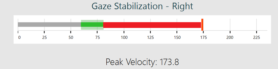 The acceptable velocity area is between about 60 to 80 degrees per second. The patient’s peak velocity is too fast at 173.8.