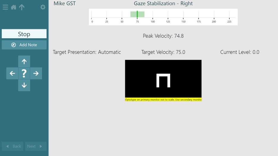 Gaze stabilization test screen. Target presentation is set to automatic. The optotype is pointing downward. The target velocity is 75.0 degrees per second. The peak velocity is 74.8, which is within a green shaded, correct range.