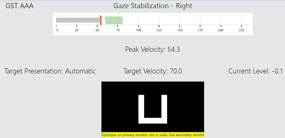 Gaze stabilization test screen. Target presentation is set to automatic. The optotype is pointing upward. The target velocity is 70 degrees per second. The peak velocity is 54.3, marked with a solid red line, which is to the left of a green shaded, correct range.