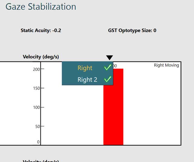 After clicking on a black, downward pointing arrow above the rightward score, ‘Right’ and ‘Right 2’ are available options in this example.