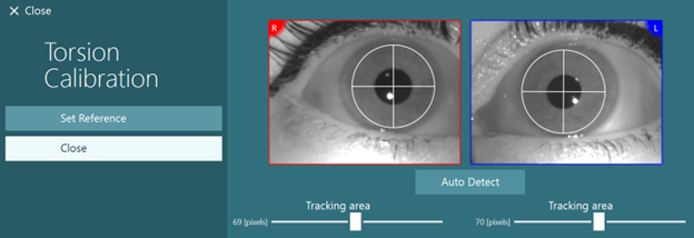 Torsion Calibration screen displaying live video of the right and left eyes. An Auto Detect function automatically detects the center of the pupil, with a customizable, circular tracking area in pixels.