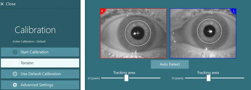 Calibration screen for torsional eye tracking. A list of options to the left, including start calibration, torsion, use default calibration, and advanced settings. Video images of the right and left eyes to the right. For both eyes, the software displays a white cross at the center of the pupil, which is encircled by a white circle. The tracking area for the right eye is set to 62 pixels. The tracking area for the left eye is set to 59 pixels.