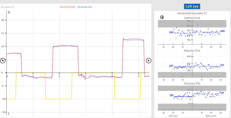 Antisaccade data, including eye position, latency, velocity, and accuracy.