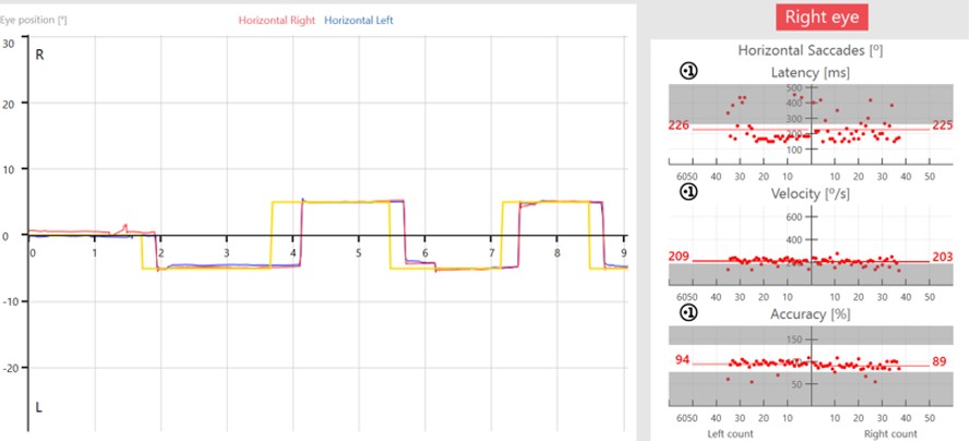Prosaccade data, including eye position, latency, velocity, and accuracy.
