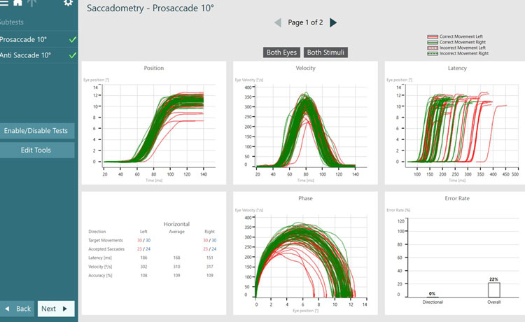 Prosaccade summary screen, including graphs for position, velocity, latency, phase, directional error rate, and overall error rate. Correct experiments are visible by solid lines, red for left and green for right. Incorrect experiments are visible by dotted lines, red for left and green for right. All experiments are correct in this overview. The position graph has eye position as a function of time, with time values ranging from 0 to 140 ms. The velocity graph has eye velocity as a function of time. The latency graph has eye position as a function of time. The phase graph has eye velocity as a function of eye position. The directional error rate is 0%. The overall error rate is 4%. There is also a chart with numerical data, including the following columns: direction, left, average, and right. And the following rows: target movements, accepted saccades, latency, velocity, and accuracy.