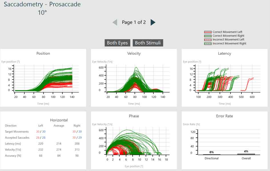 Prosaccade summary screen, including graphs for position, velocity, latency, phase, directional error rate, and overall error rate. Correct experiments are visible by solid lines, red for left and green for right. Incorrect experiments are visible by dotted lines, red for left and green for right. All experiments are correct in this overview. The position graph has eye position as a function of time, with time values ranging from 0 to 140 ms. The velocity graph has eye velocity as a function of time. The latency graph has eye position as a function of time. The phase graph has eye velocity as a function of eye position. The directional error rate is 0%. The overall error rate is 4%. There is also a chart with numerical data, including the following columns: direction, left, average, and right. And the following rows: target movements, accepted saccades, latency, velocity, and accuracy.