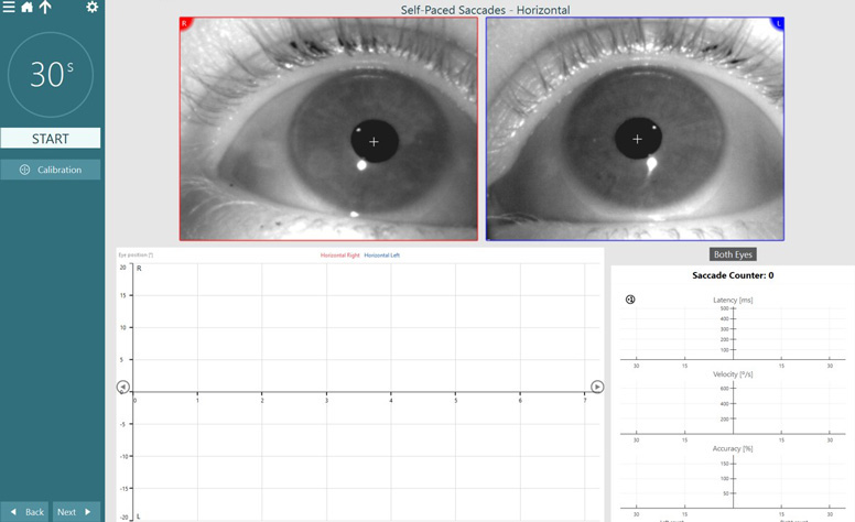 Several graphs are on this screen, all as a function of time. Eye position, latency, velocity, and accuracy.