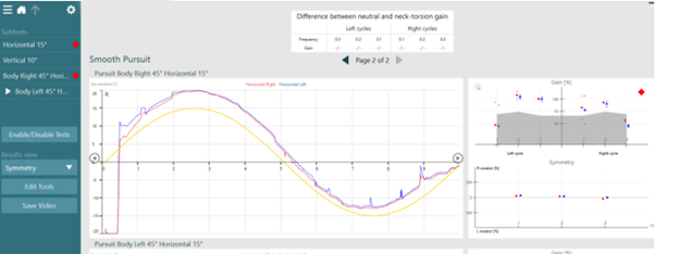There are data and graphs for eye position, gain, symmetry, and the difference between neutral and neck torsion gain.