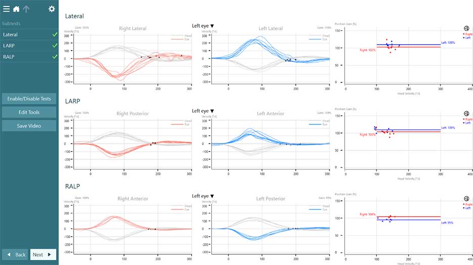 vHIT for VORTEQ results overview, including the subtests lateral, LARP, and RALP. Each of the three subtests display results for eye velocity and position gain.