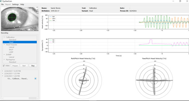 Calibration data, including head velocity and eye position.