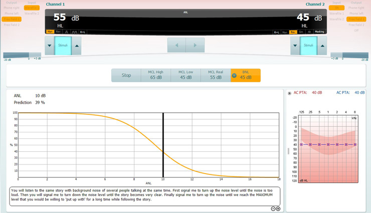 For this test, the patient is instructed to turn up the background noise level until it is too loud. Then turn down the background noise level until the speech material is very clear. Finally, turn up the background noise level until the patient reaches the maximum level that they would be willing to put up with for a long time while following the speech material. In this example, the patient’s ANL value is 10 dB and the patient’s performance prediction with amplification is 39%.