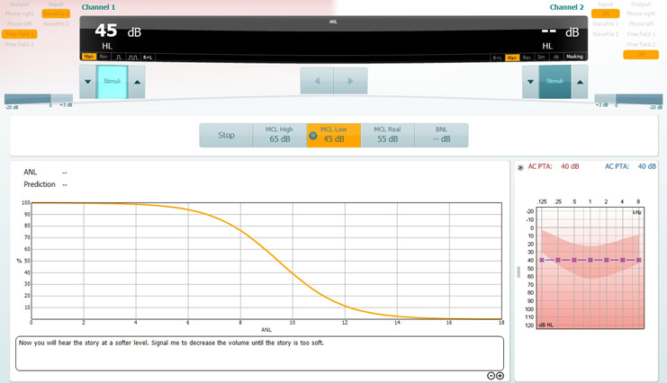 For this test, the patient is instructed to decrease the loudness of speech until it is too low. In this example, the MCL High is 65 dB and the MCL Low is 45 dB. Thus, as a midpoint between the MCL High and MCL Low, the predicted MCL Real is 55 dB.