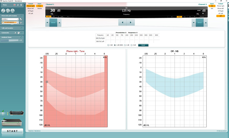 In addition to the ordinary controls for channels 1 and 2 and the audiograms, there is a table that shows the SISI percentage for the right and left ears for individual frequencies.