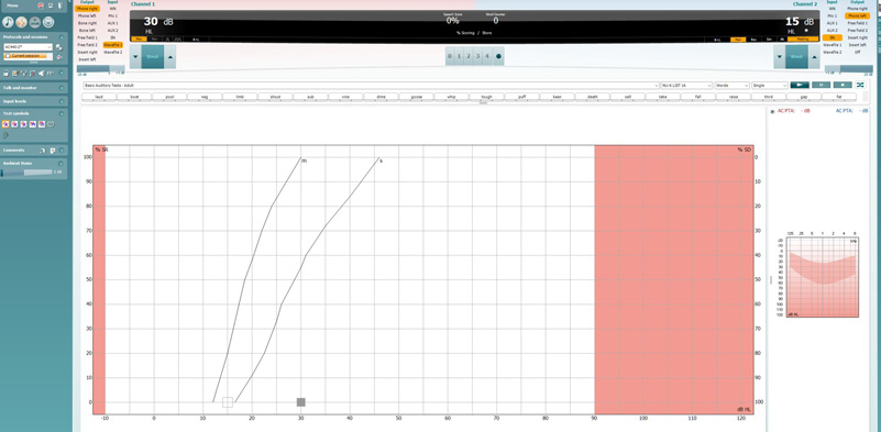 There are output, input, stimulus level, and stimulus presentation controls for channels 1 and 2. In the top-middle there is a percentage speech score and word counter, below which the user can score the responses, in this example number of correct phonemes from zero to four. To the right there is the patient’s audiogram and pure tone average. The main part of the screen is the speech audiogram, displaying speech recognition and speech detection as a function of dB HL.