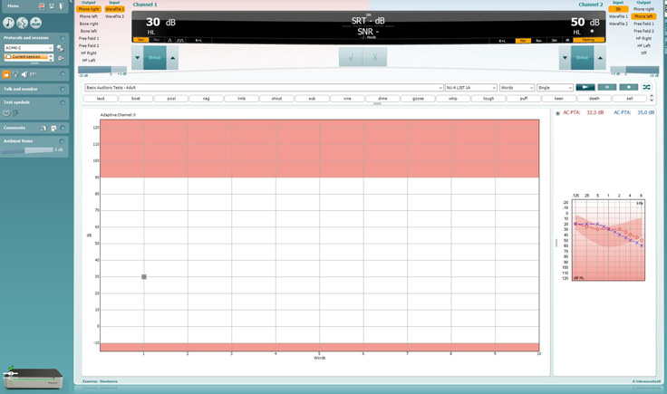 At the top it is possible for channels 1 and 2 to: Change the output, change the input, alter the level, or present the stimulus. In the middle the calculated SRT and SNR are displayed, below which the user can press a tick button or cross button to score responses. Based on the patient’s pure tone audiogram and with a pure tone average of 32.5 dB, the initial stimulus level is set to 30 dB.