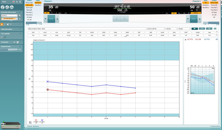 At the top it is possible for channels 1 and 2 to: Change the output, change the input, alter the level, or present the stimulus. In the middle the calculated SRT and SNR are displayed, below which the user can press a tick button or cross button to score responses. Based on the patient’s pure tone audiogram and with a pure tone average of 35 dB, the initial stimulus level is set to 35 dB.