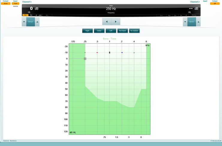 Below output, input, stimulus level, and stimulus presentation controls for channels 1 and 2, there is a graph with dB HL as a function of kHz. At each frequency, the patient has indicated whether they heard the tone better in the right or left ear, equal in both ears, or not heard at all.