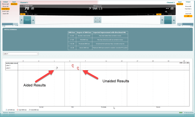 Three results can be seen. For the same wordlist, the unaided SNR score indicates a mild SNR loss, while the aided SNR loss is 1.5 dB, which is normal.