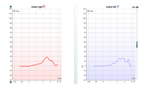 Aided REUR measurements for the left and right ears. Both curves peak at about 3 kHz and cross the x-axis at about 6 kHz.