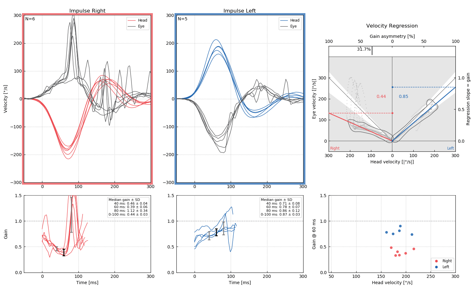Lateral Test Utilizing Video Head Impulse Test (vHIT)