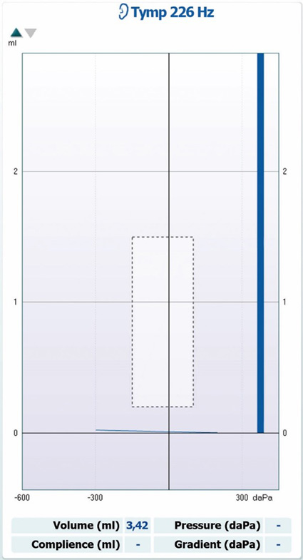 Ear canal volume of 3.42 ml. No values for compliance, pressure, or gradient.