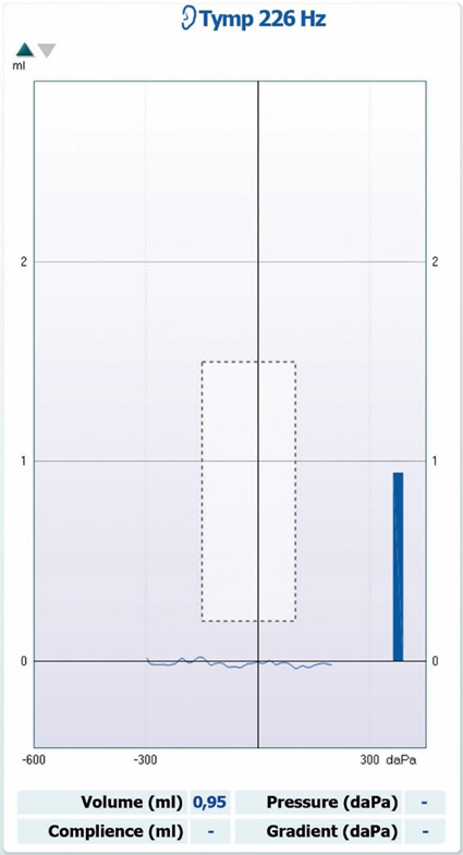 Ear canal volume of 0.95 ml. No values for compliance, pressure, or gradient.