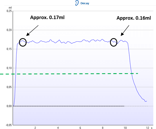 A diagram for plotting findings for tympanometry and acoustic reflexes