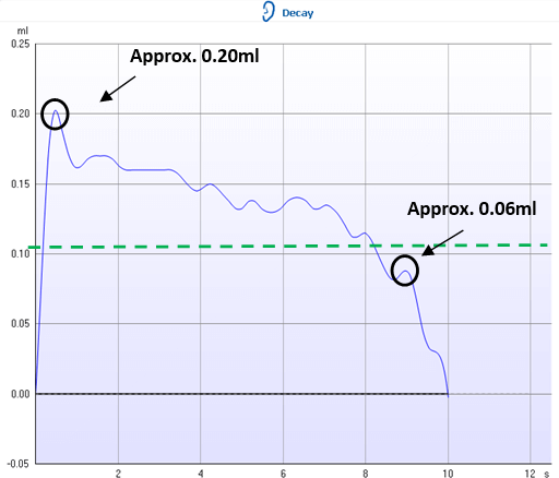 Positively displayed acoustic reflex. The deflection value at onset is about 0.20 ml. The deflection value after 10 seconds is about 0.06 ml. Thus, the response crosses the 50% threshold at about 0.10 ml, which is visible by a green dotted line.