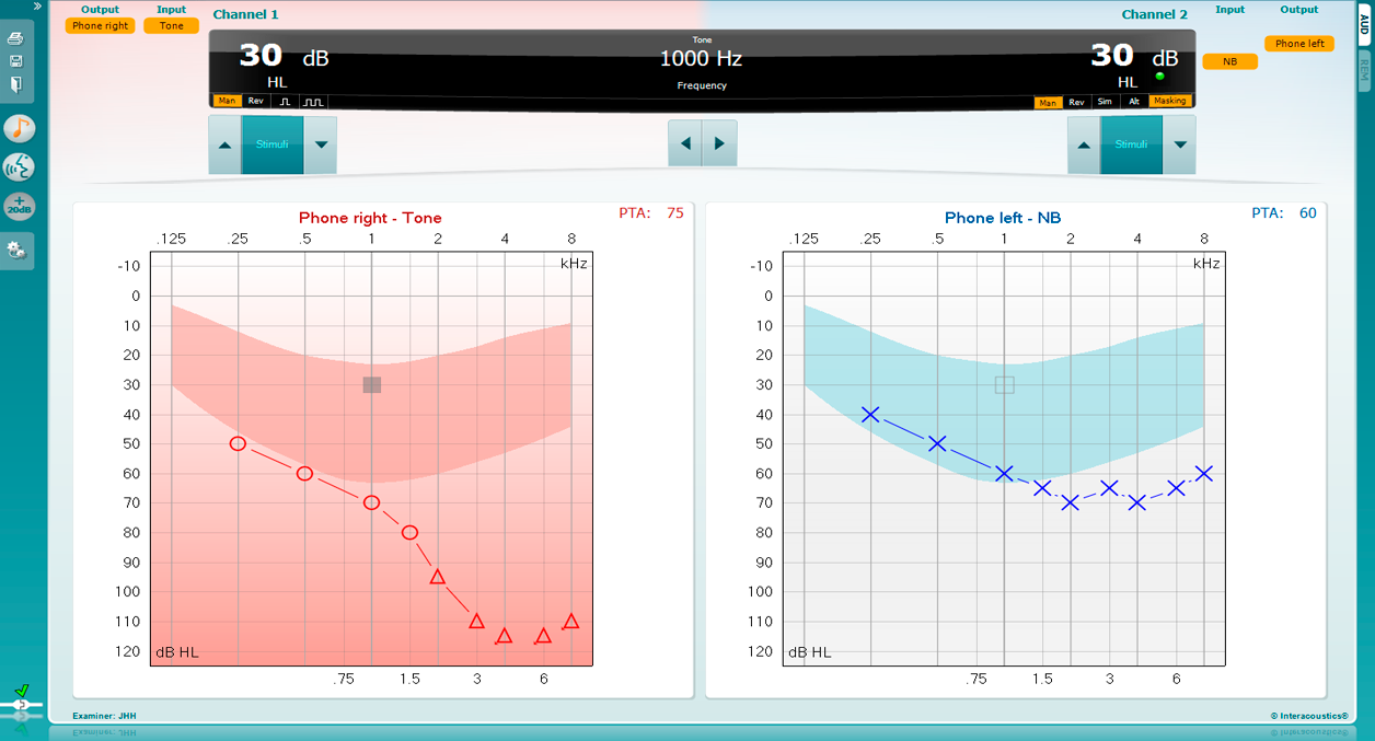 Pure tone audiometry software screen