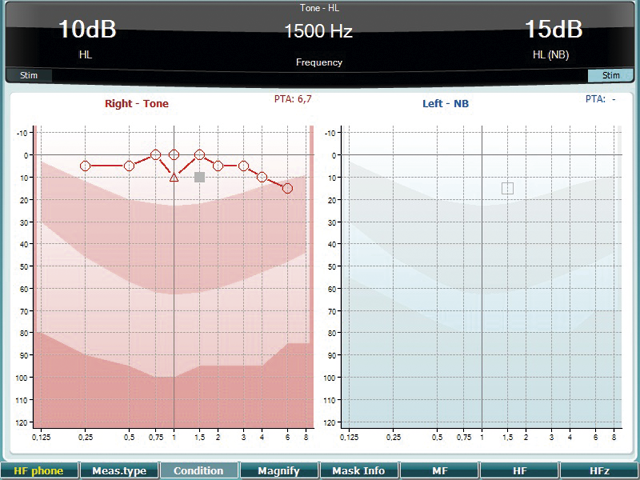 Pure tone audiometry software screen