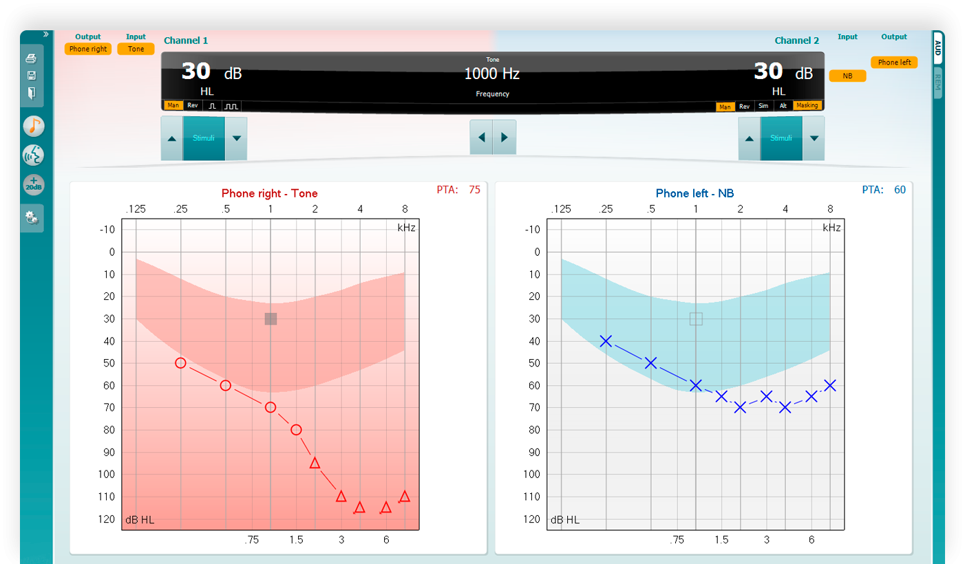 Pure tone audiograms