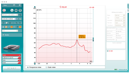 Real ear unaided response software screen
