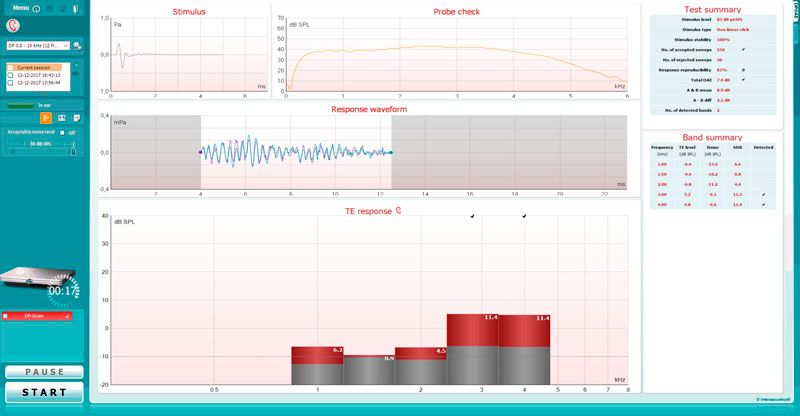 TEOAE software screen