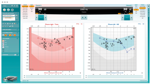 Pure tone audiograms