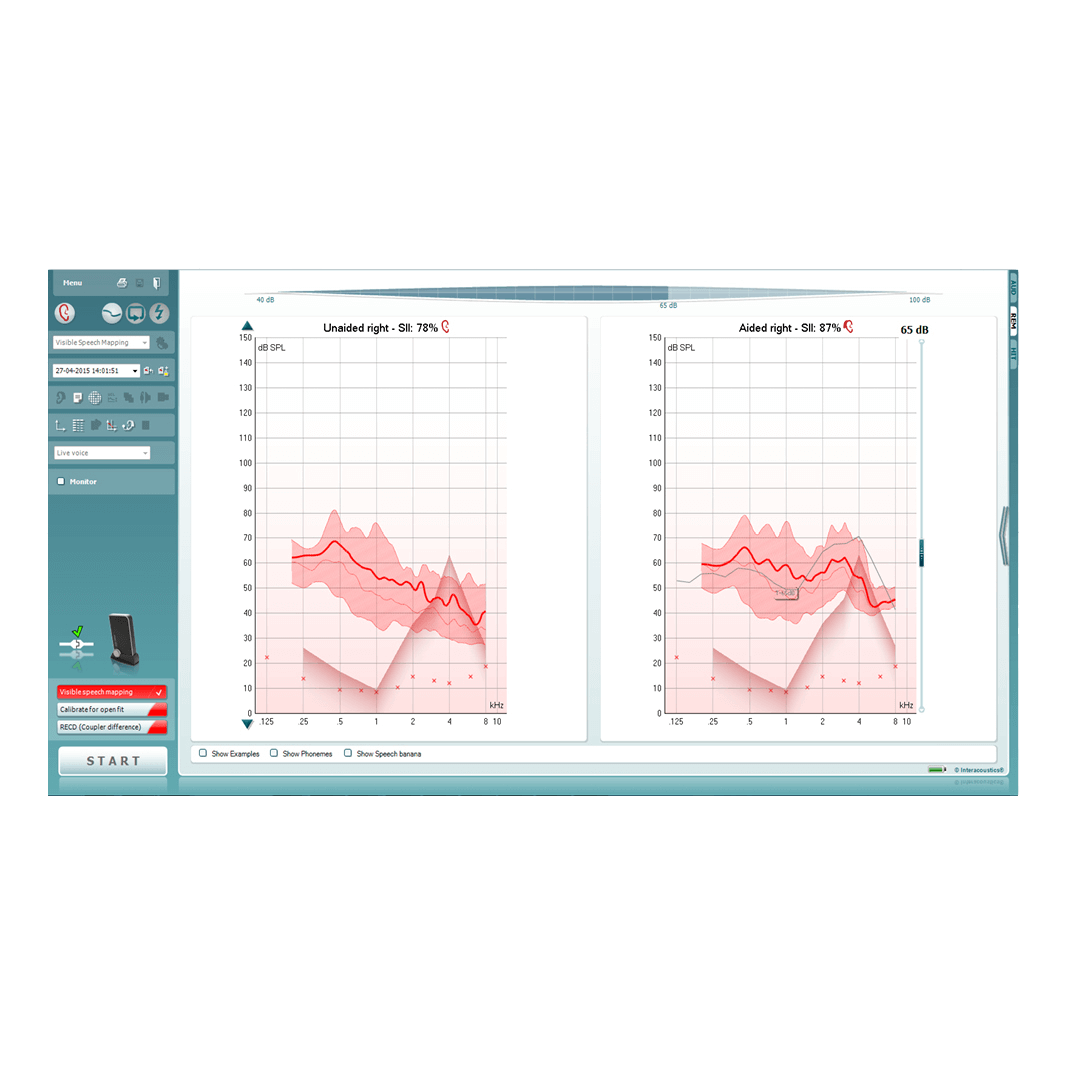 Laptop with visible speech mapping software.