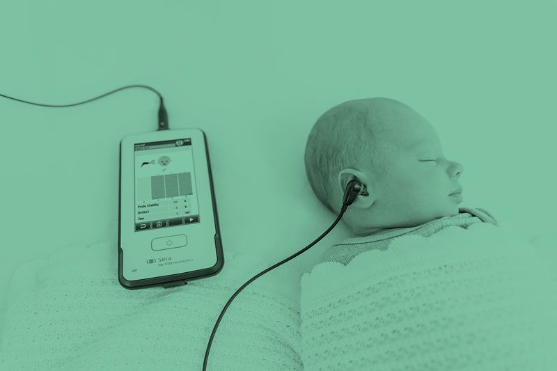 Sleeping baby with Sera SnapPROBE inserted into right ear