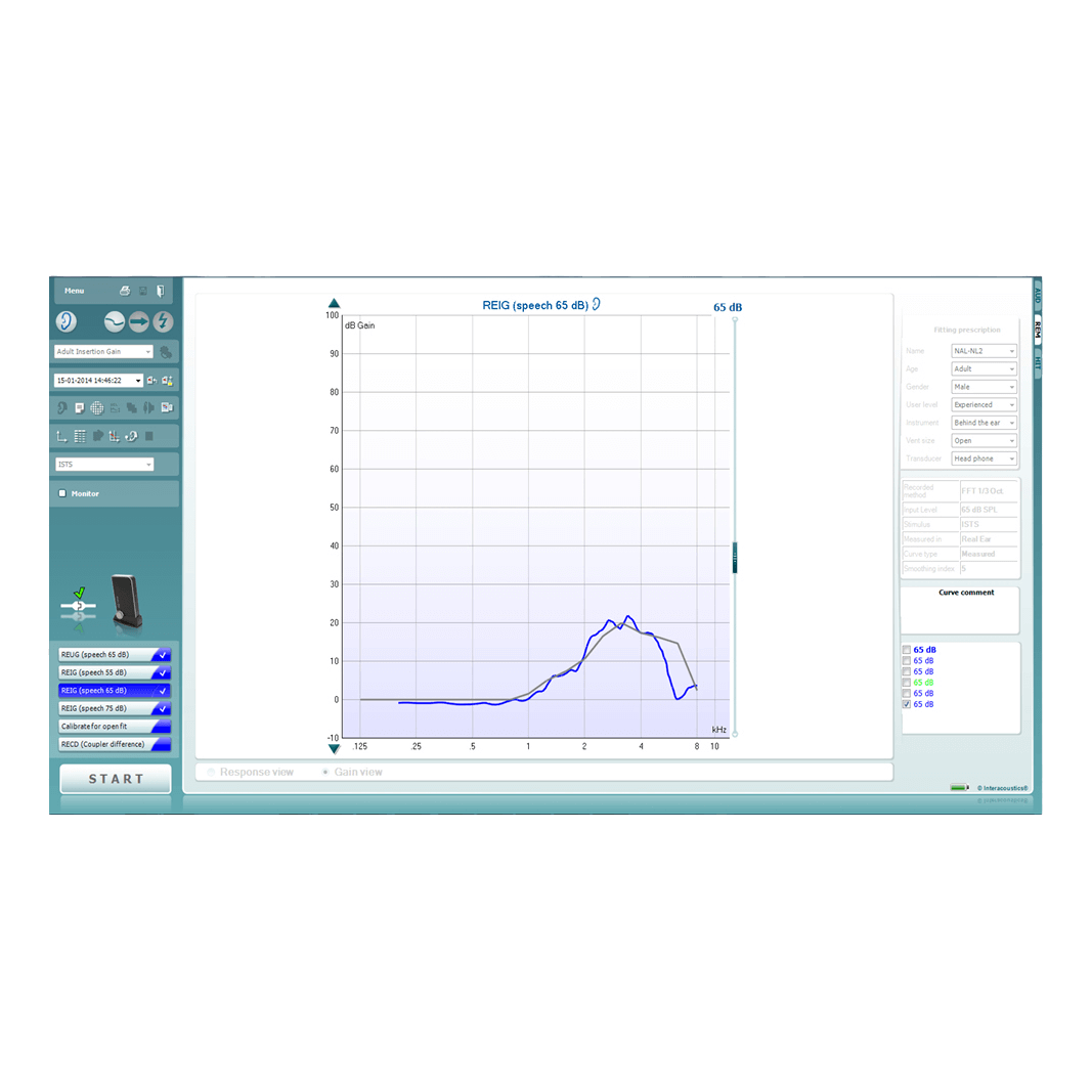 Laptop with real-ear measurement software.